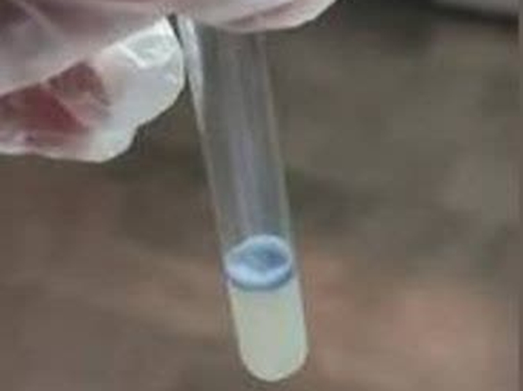 انجام تست حلقه شیر و بررسی وضعیت بیماری بروسلوز